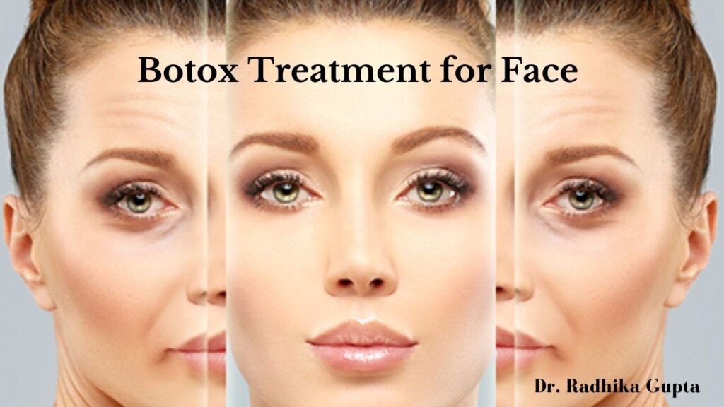 Botox Treatment for Face 