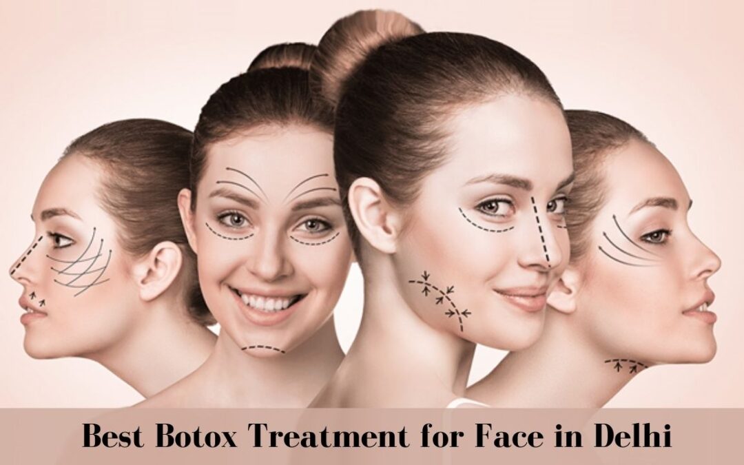 Botox Treatment for Face in Delhi - Rgaesthetics