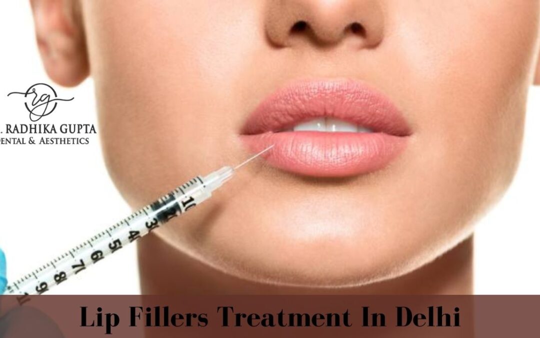 Lip Fillers Treatment In Delhi | Dr. Radhika Gupta