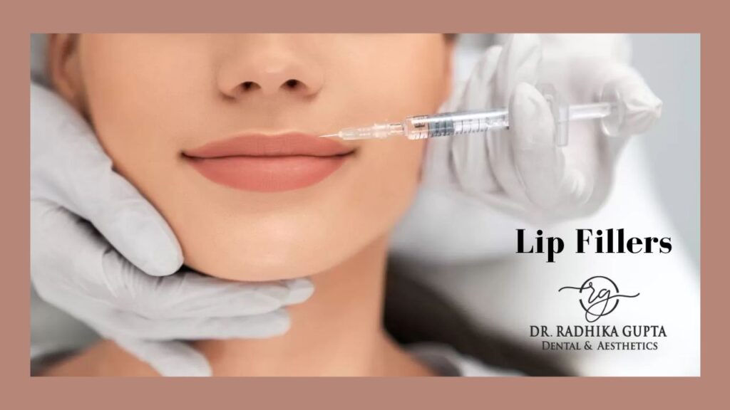 Lip Fillers Treatment In Delhi